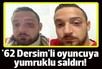 '62 Dersim'li oyuncuya yumruklu saldırı!