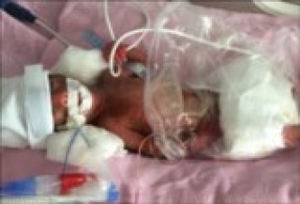 670 gram doğan bebek helikopterle Ankara'ya sevk edildi