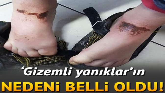 Afyonkarahisardaki gizemli yanıkların nedeni belli oldu