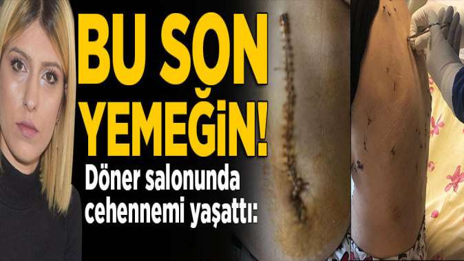 Bu son yemeğin, güzel ye dedi ve dehşeti yaşattı! 38 yerinden bıçakladı