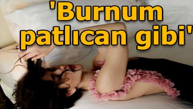 Burnum patlıcan gibi