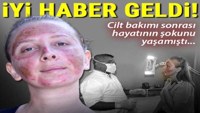 Cilt bakımı sonrası hayatının şokunu yaşamıştı… İyi haber geldi