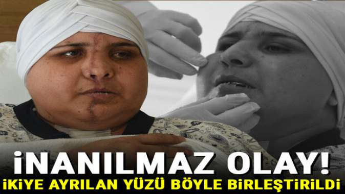 Eskişehirde inanılmaz olay! İkiye ayrılan yüzü böyle birleştirildi