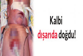 Kalbi dışarıda doğdu