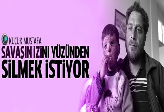 Küçük Mustafa savaşın izini yüzünden silmek istiyor