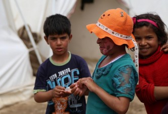 Suriyeli Emira'nın yüzündeki savaşın izleri silinecek
