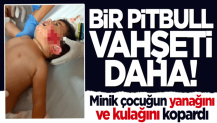 Bir Pitbull vahşeti daha! Minik çocuğun yanağını ve kulağını kopardı