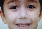 Boğazına tost parçası kaçan çocuk, 23 gün sonra öldü