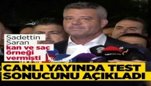 Canlı yayında Sadettin Saran'ın test sonuçlarını açıkladı! Kan ve saç örneği vermişti