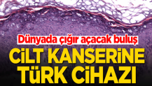 Dünyada çığır açacak buluş! Cilt kanserine Türk cihazı