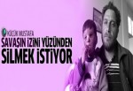 Küçük Mustafa savaşın izini yüzünden silmek istiyor