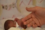 Parmak bebeğin yaşam savaşı