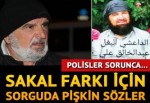 Sakal farkı