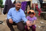 Suriyeli Emira "estetik" ameliyat için yardım bekliyor