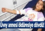 Üvey annesi öldüresiye dövdü!