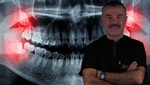 YİRMİLİK DİŞLER İHMALE GELMİYOR! UZMANI UYARDI: GÜLÜŞÜNÜZ BOZULABİLİR
